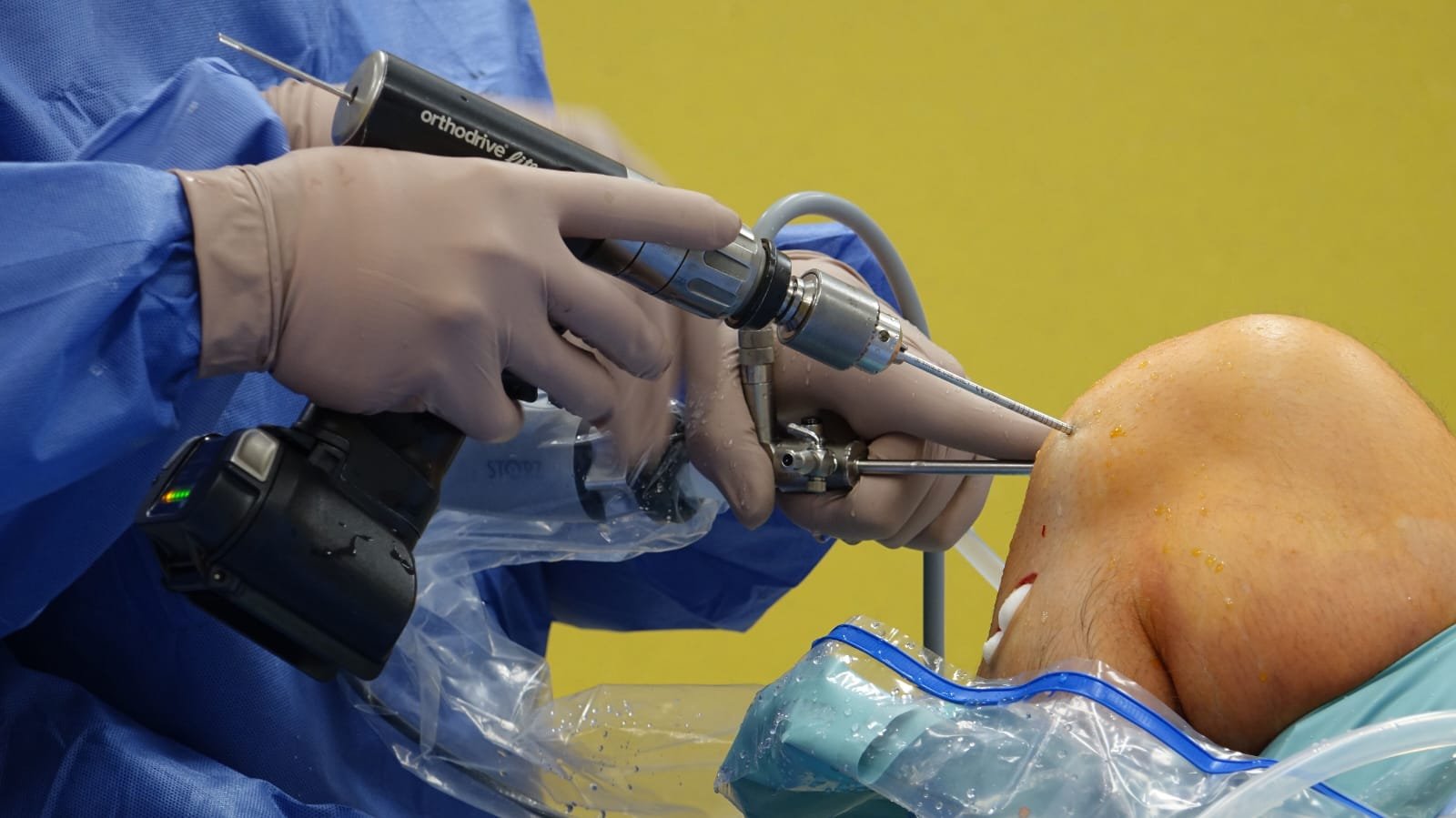 Surgery for Complex Knee Trauma